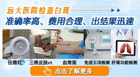 白斑伍德灯无荧光还需要做其他检查吗