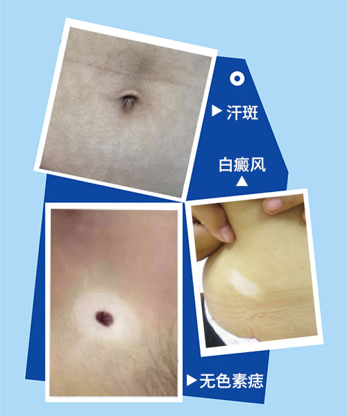 脚底前脚掌一块白的图片