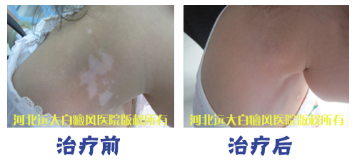 医者仁心 救助绝望少女