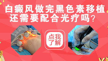 脸部长了白癜风症状是什么样的