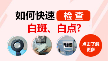 面部白癜风危害大 及时治疗是关键