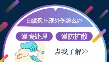 手心有一块白斑是不是白癜风