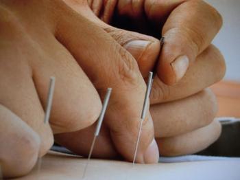 针灸能医白癜风吗