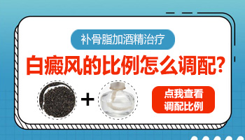 女性在夏季患白癜风的早期症状表现有哪些