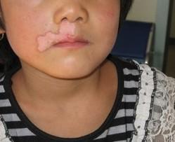 嘴上一点点小白点是不是白癜风?