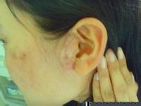 脖子和脸上的白斑可以遮盖的住么?有没有副作用?