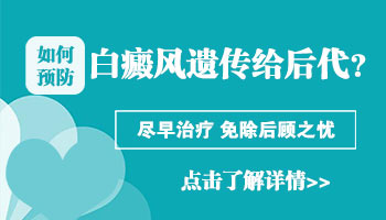 白癜风进展期和稳定期的诊断怎么进行