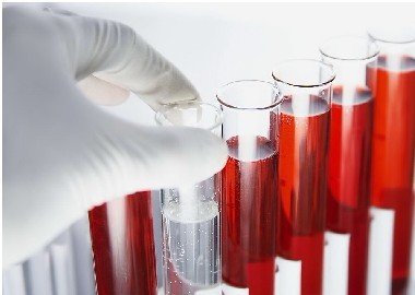 白癜风患者必要时需进行血液检查吗