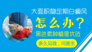 白癜风的主要危害都有哪些呢