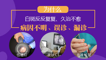 身上的白癜风没能要孩子吗