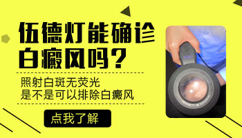 白癜风发痒能进行UVB光照吗