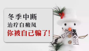 女性面部白癜风的早期症状有哪些