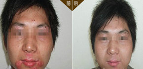 石家庄白癜风医院预约电话