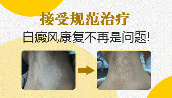 避免白癜风遗传给孩子的方法