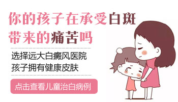 白癜风患者可以染发吗