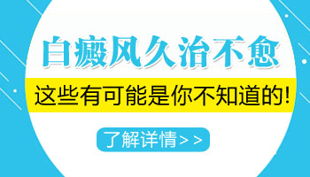 女性白癜风应该怎么治疗效果好
