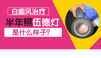 嘴唇里面有很多小白点是怎么回事