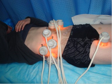 白癜风种植后注意些什么