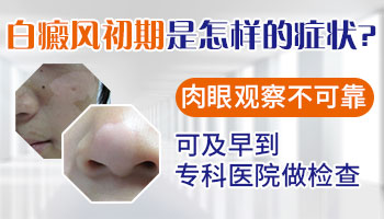 儿童得了白癜风去石家庄哪儿治疗好
