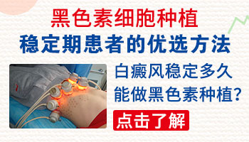 女性白癜风治疗要注意什么