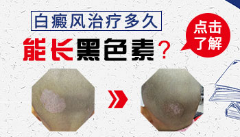 青少年腿上长白斑该怎么办