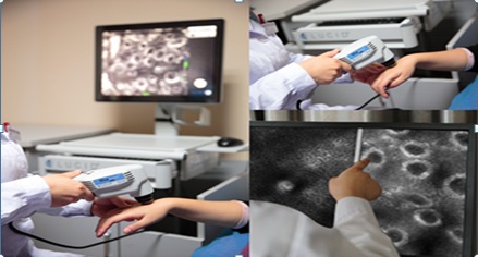 三维皮肤CT诊断