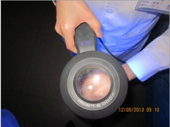 在邢台怎样选择治疗白癜风的方法呢