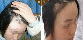 怎样针对白癜风的症状来进行治疗