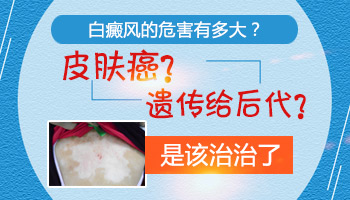 廊坊哪家医院可以治疗3岁宝宝胸口白癜风呢