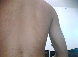 白癜风复发了去邯郸哪家医院治疗能好呢