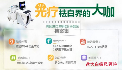 白癜风主要发病特点有哪些