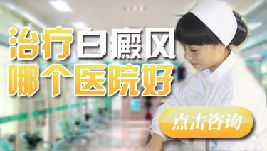 得了白癜风的原因都是什么