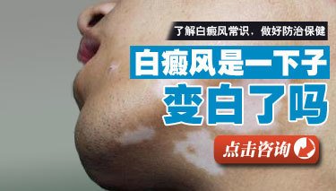 面部白癜风不扩散怎么治