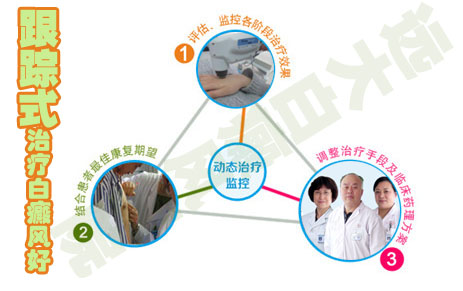 白癜风要多长时间到稳定期