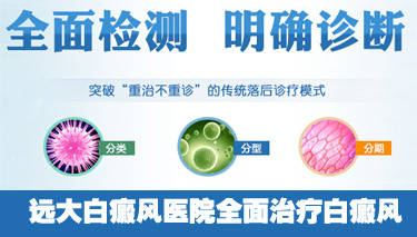 儿童得了白癜风能治好吗