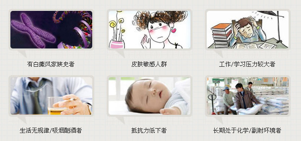 女性白癜风如何治疗