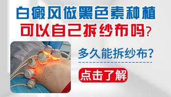 白癜风治疗注意的细节有哪些