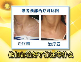 全身白癜风选择什么方法治疗合算