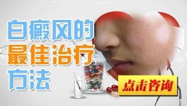 治疗白癜风什么方式好