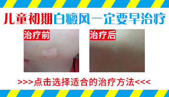 白癜风医院治疗一般时间很长，什么搞的鬼