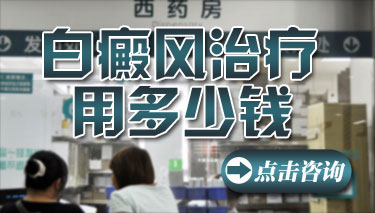 紫外线照射治疗青年白癜风花费贵吗