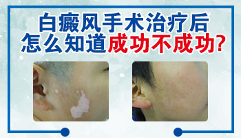 白癜风患者使出洪荒之力看奥运?当心白斑扩散