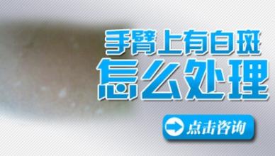 青少年四肢白癜风要怎么治疗