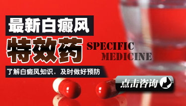 多年的白癜风治疗要怎么做