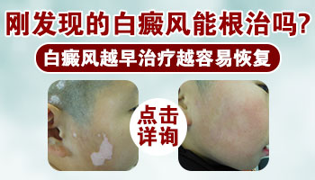 预防白癜风的发生