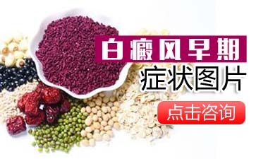 你怀疑自己有白癜风，跟着教你判断小白斑