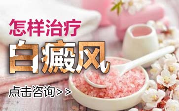 病情轻的白癜风能不能完全治好