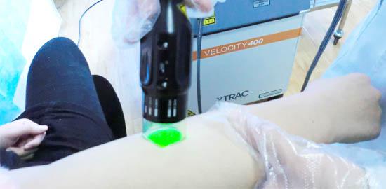 孩子得白癜风，大部分怪家长