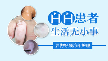 白癜风复发几率大，怎么避免