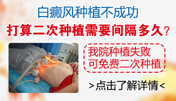 治疗白癜风方法这么多，你适合哪种？